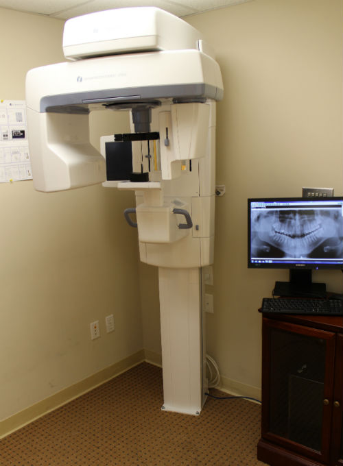 Digital Panoramic X-Rays | Calcaterra Dentistry | Panorex Orange, CT
