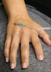 IV in hand for IV sedation dentistry Dr. Nick Calcaterra in Orange, CT